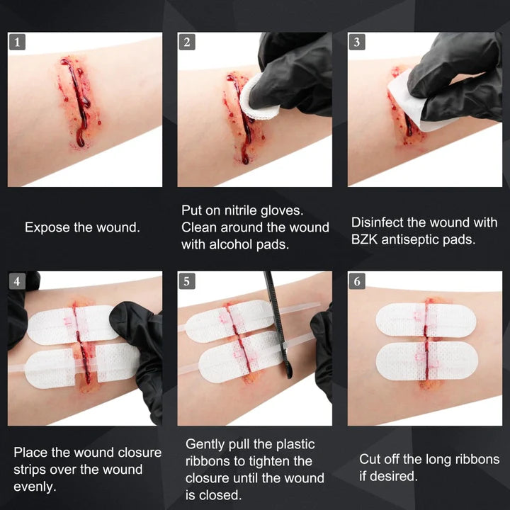 Wound Closure Kit